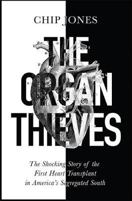 The Organ Thieves: The Shocking Story of the First Heart Transplant in America's Segregated South